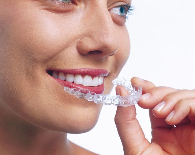Aligneurs invisibles (Invisalign)